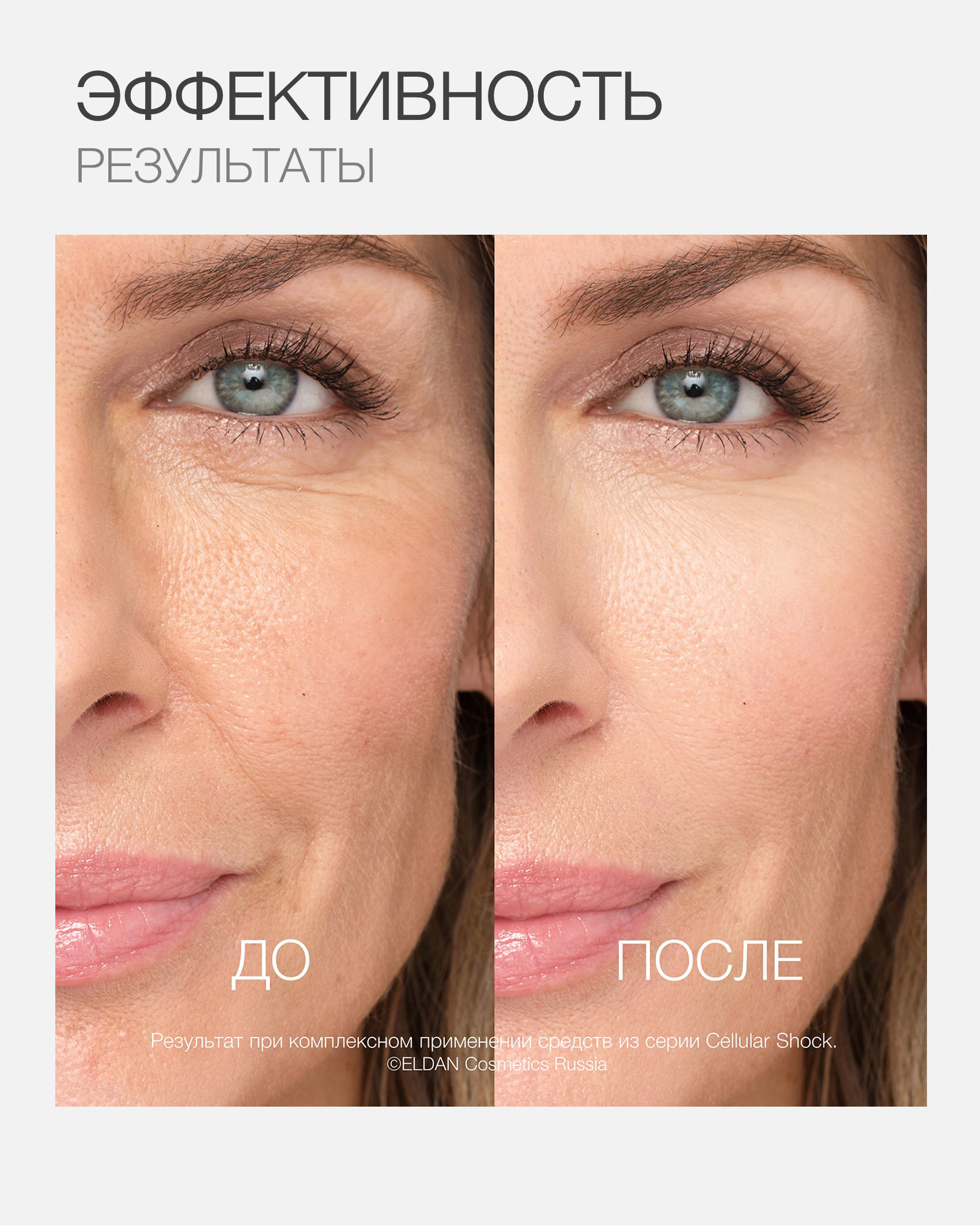 Пост матриксил 6.jpg Пост матриксил 6.jpg